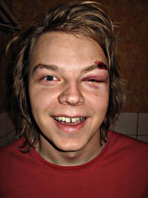 Tuomas Skopa 2010